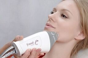 جوهر إجراء تجديد جزئي لبشرة الوجه